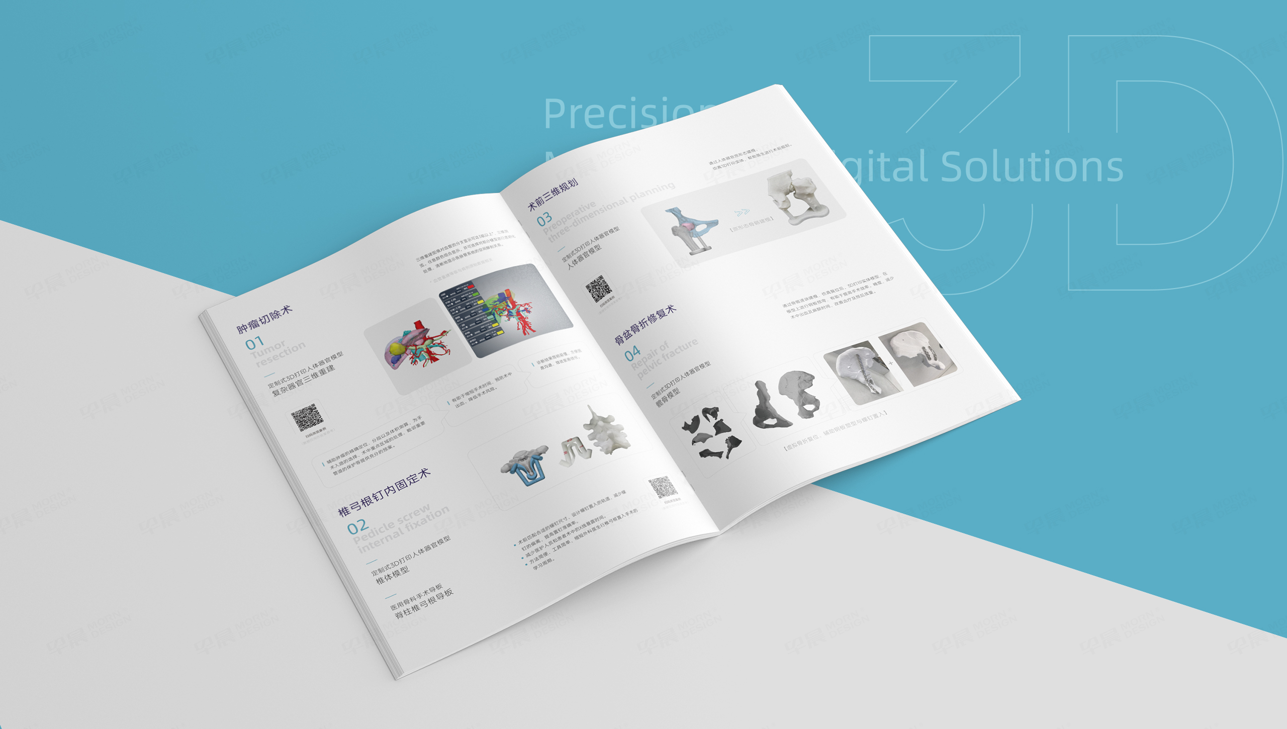 宣传画册设计,画册制作,医疗画册,苏州,无锡,常州,南通,泰州,张家港,江阴,太仓,昆山,常熟,靖江,设计公司,杉谛增材 